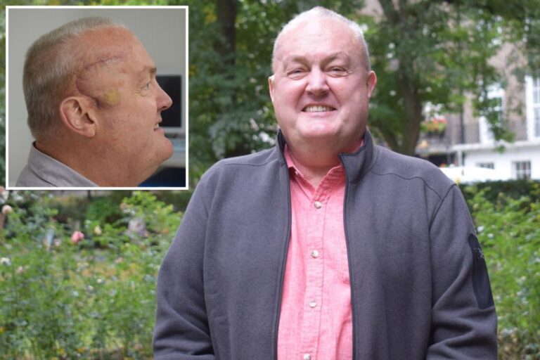 UK engineer's 'aggressive' tumor shrinks by 50% in just 6 weeks after first-of-its-kind experimental trial

