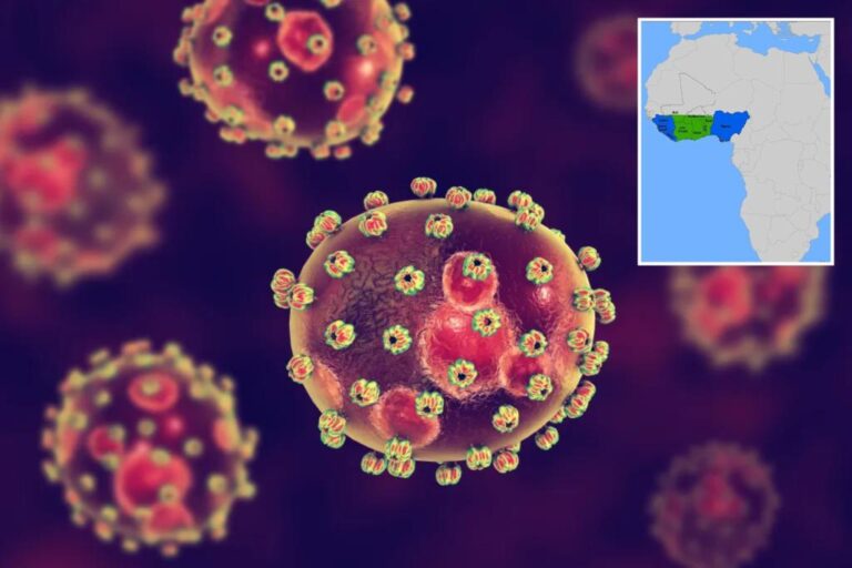 Iowa man dies from suspected West African virus that could cause permanent hearing loss

