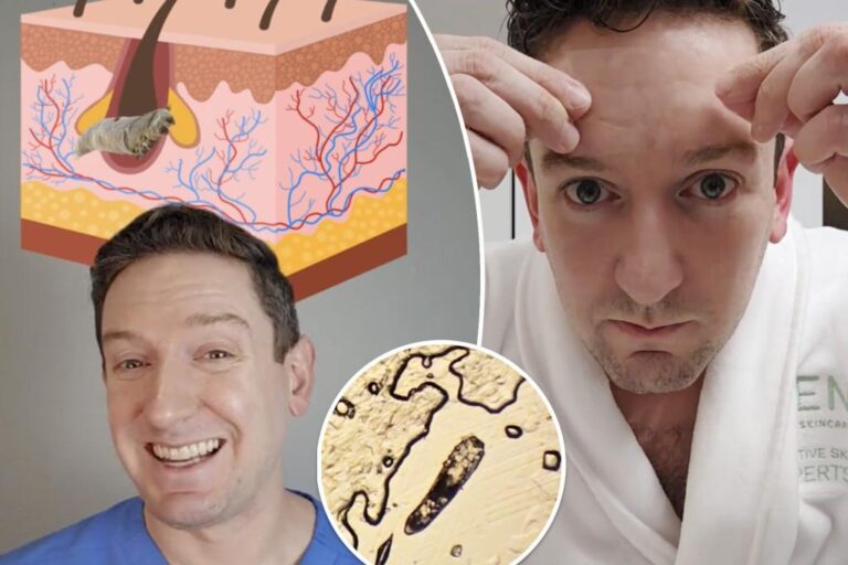 Demodex mites are living, mating on your face - what you need to know

